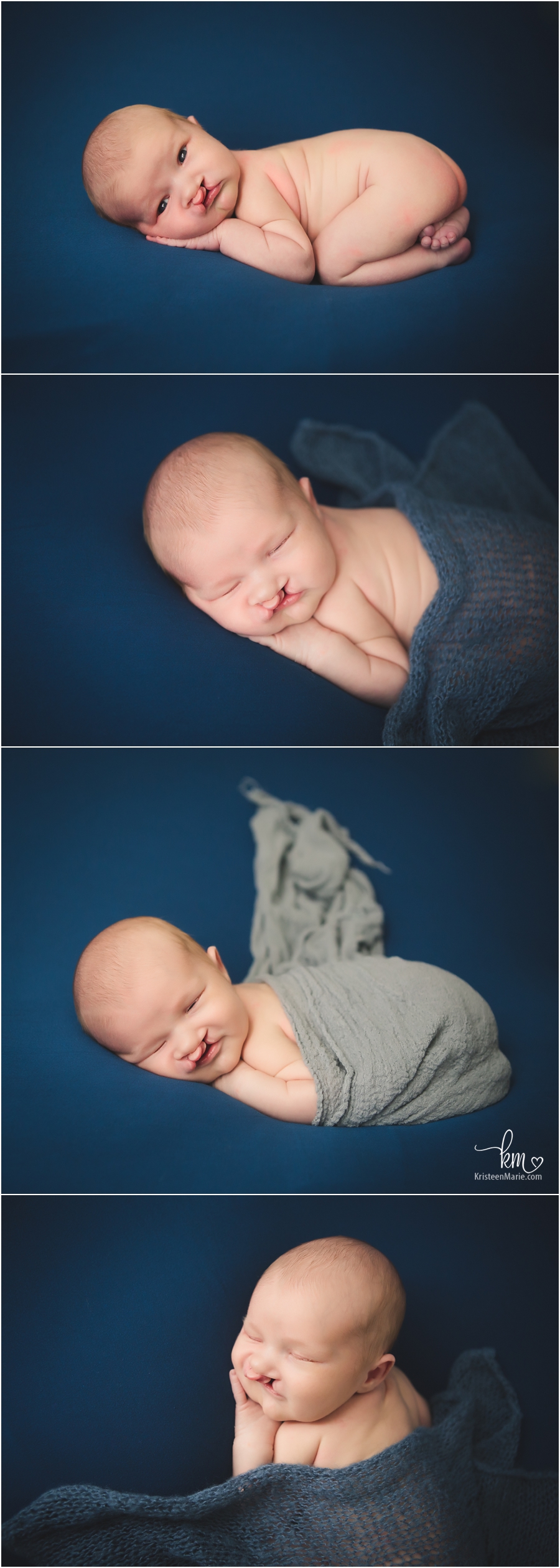 newborn boy on navy - baby with cleft lip newborn photography