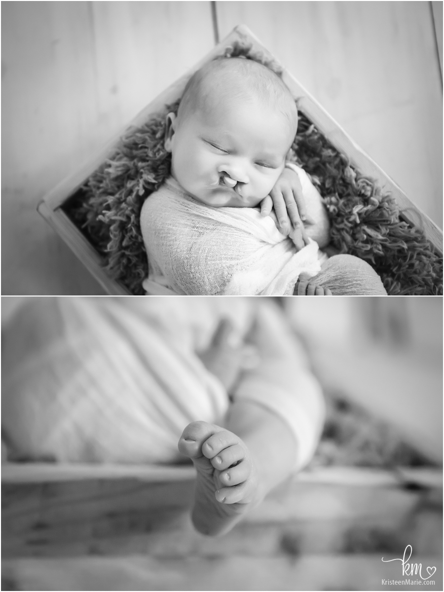 black and white pictures of newborn baby with cleft lip